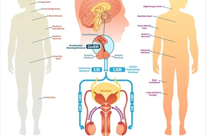 testosterone replacement therapy